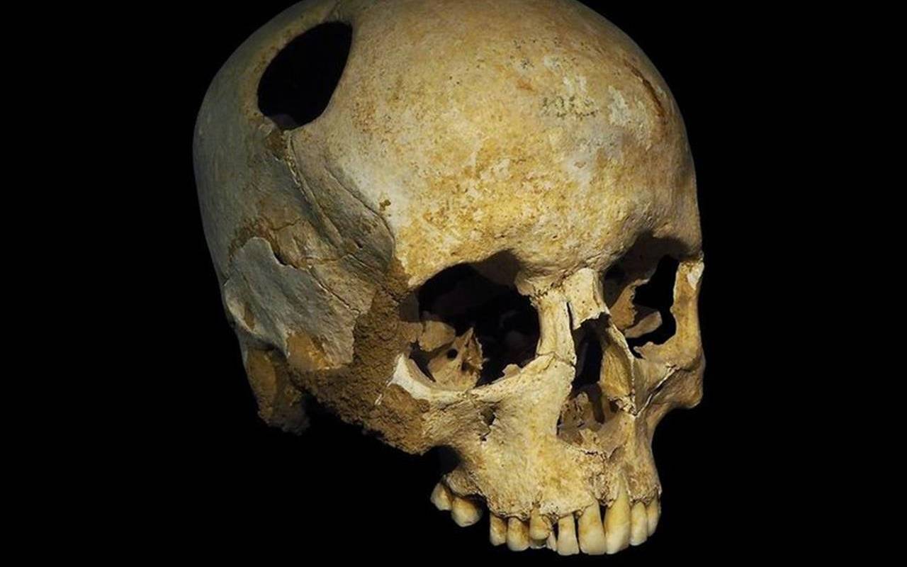 Galvaskauss, Kas Maina Visu: Miljonu Gadu Vecs Fosilija Liecina, Ka Homo Sapiens Nav Cēlies No Āfrikas.