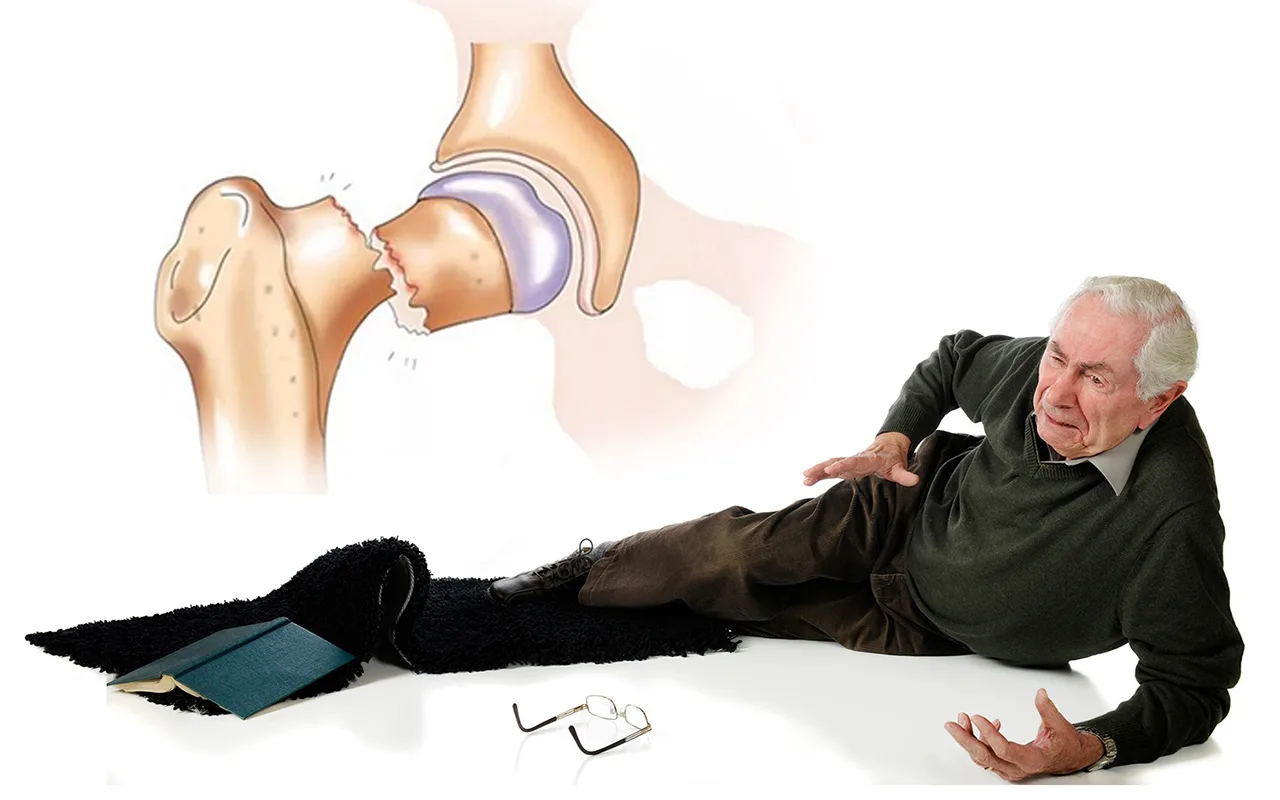 „Es Zaudēju Līdzsvaru Un Krītu, Tāpēc Reti Izkāpju Ārā”: Kritieni Vecāka Gadagājuma Cilvēkiem, Kā Izvairīties No Neuzmanības?